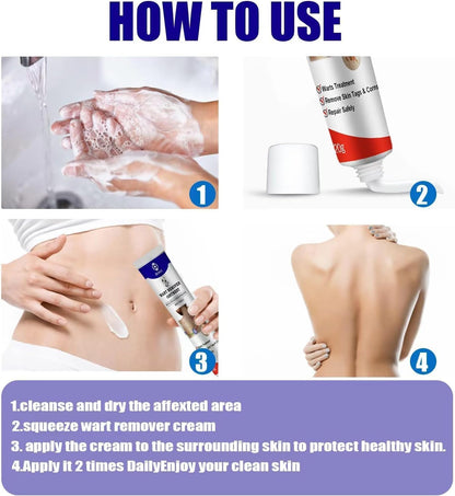 Warts Remover ointment